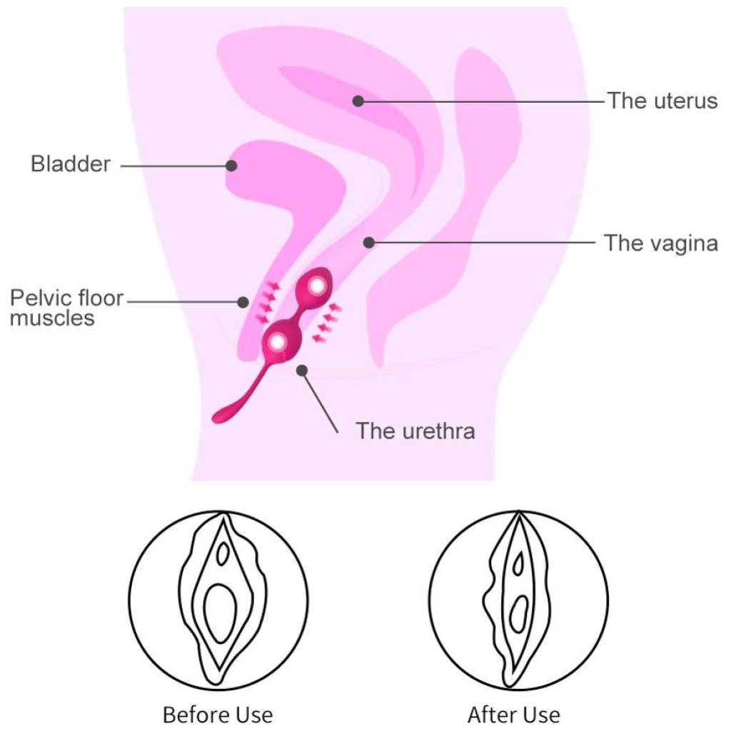 Levett-Siliconen-Kegel-Ballen-Ben-Wa-Bal-Vaginale-Draai-Oefening-Ei-Massager-Volwassen-Trainer-Koppels-Seksspeeltjes-5