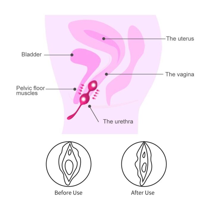 Levett-Siliconen-Kegel-Ballen-Ben-Wa-Bal-Vaginale-Draai-Oefening-Ei-Massager-Volwassen-Trainer-Koppels-Seksspeeltjes-5